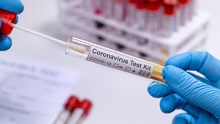 Grace Silica Goes into Promega’s Purification Kits to Enable COVID-19 PCR Testing